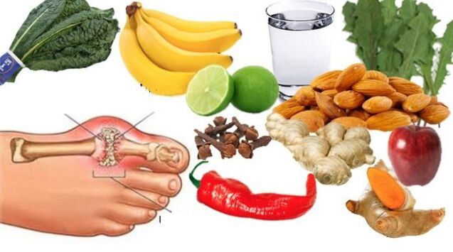 Gout patients are prescribed a gentle diet